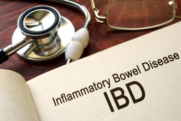 The ultimate guide to inflammatory bowel disease 