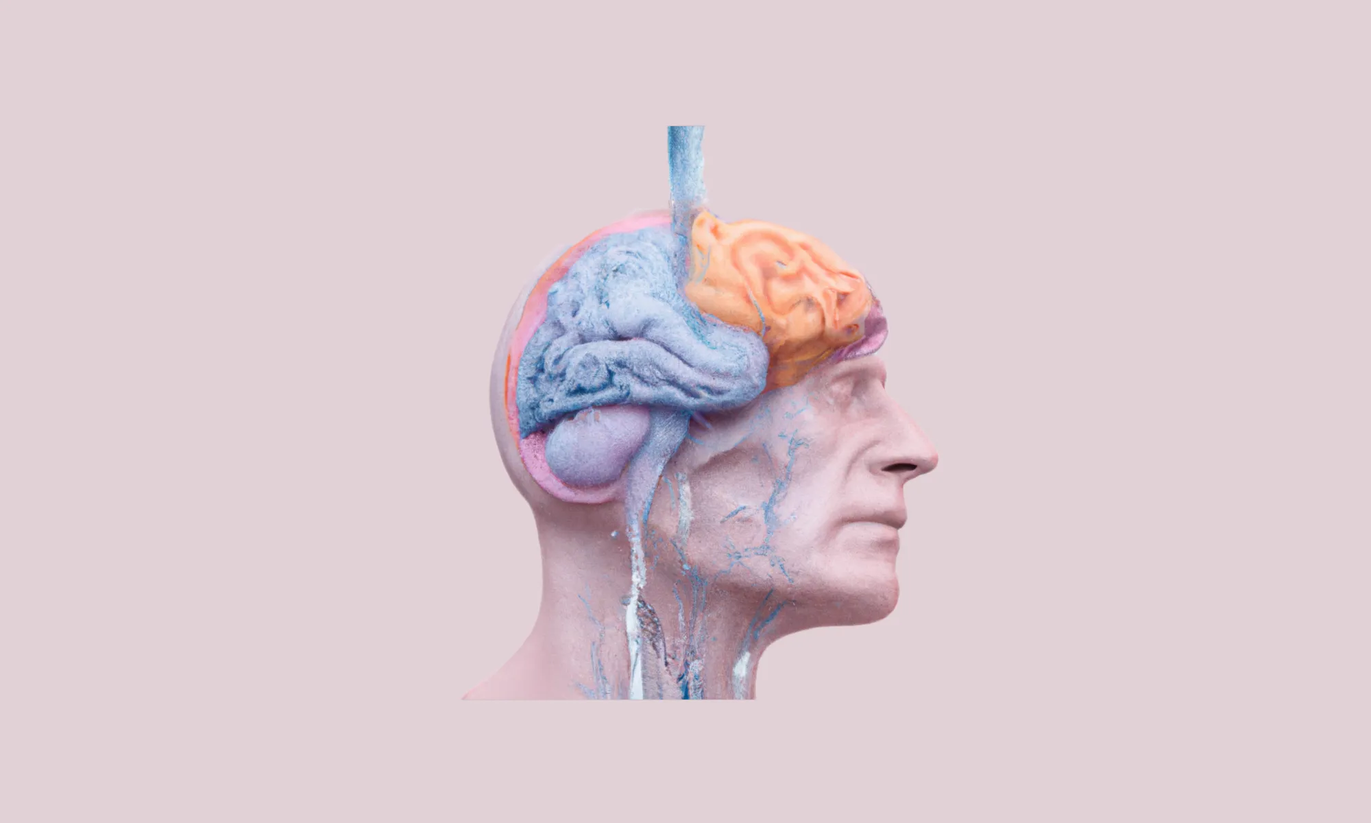Whitepaper: Validating Orchid’s Alzheimer’s Disease Genetic Risk Score